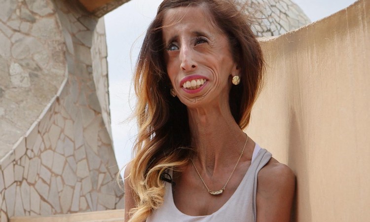 lizzie velasquez melissa cowan